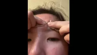 popping pimple :)